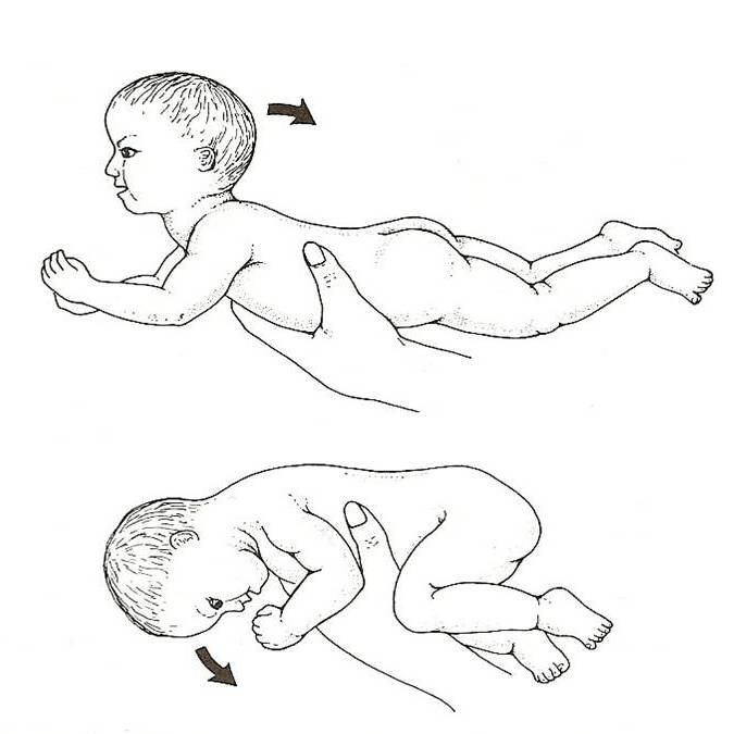 trlreflex1